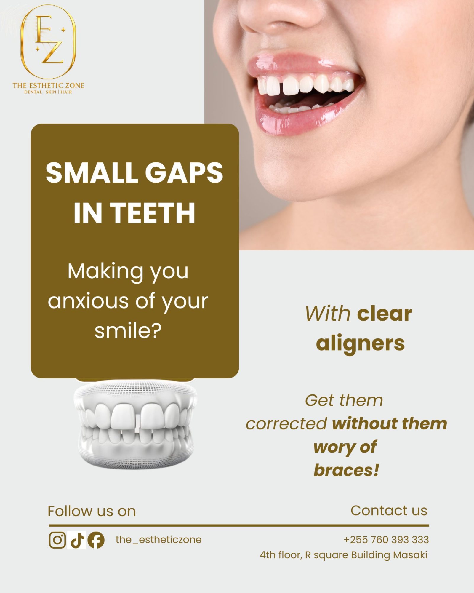 Fix Small Gaps in Teeth with Clear Aligners in Dar es Salaam